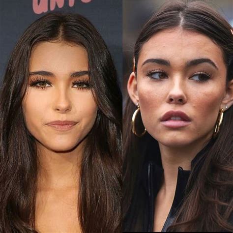 madison beer plastic sugery|Madison Beer Before And After Lip Fillers —Yay Or。